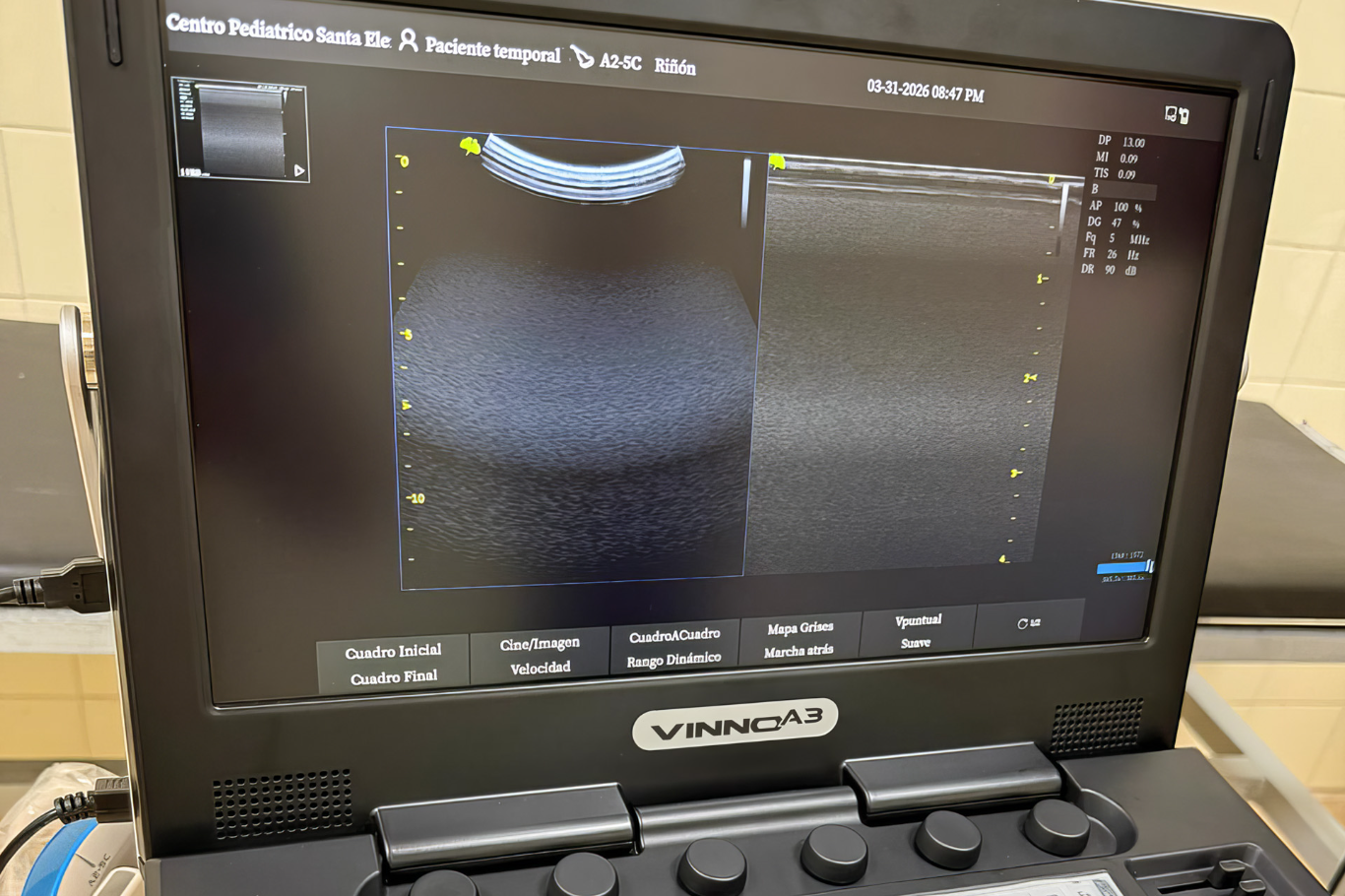 Salud incorporó ecógrafos en tres hospitales para fortalecer la atención sanitaria